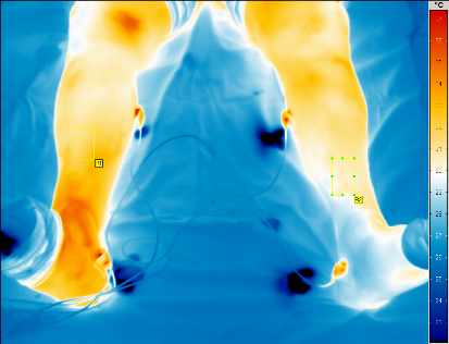 IR Neurochirogie Bild